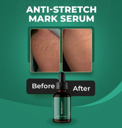 Markaway Stretch Mark Serum – Herbal Formula for Hydration, Skin Toning & Dark Spot Correction (30ml)